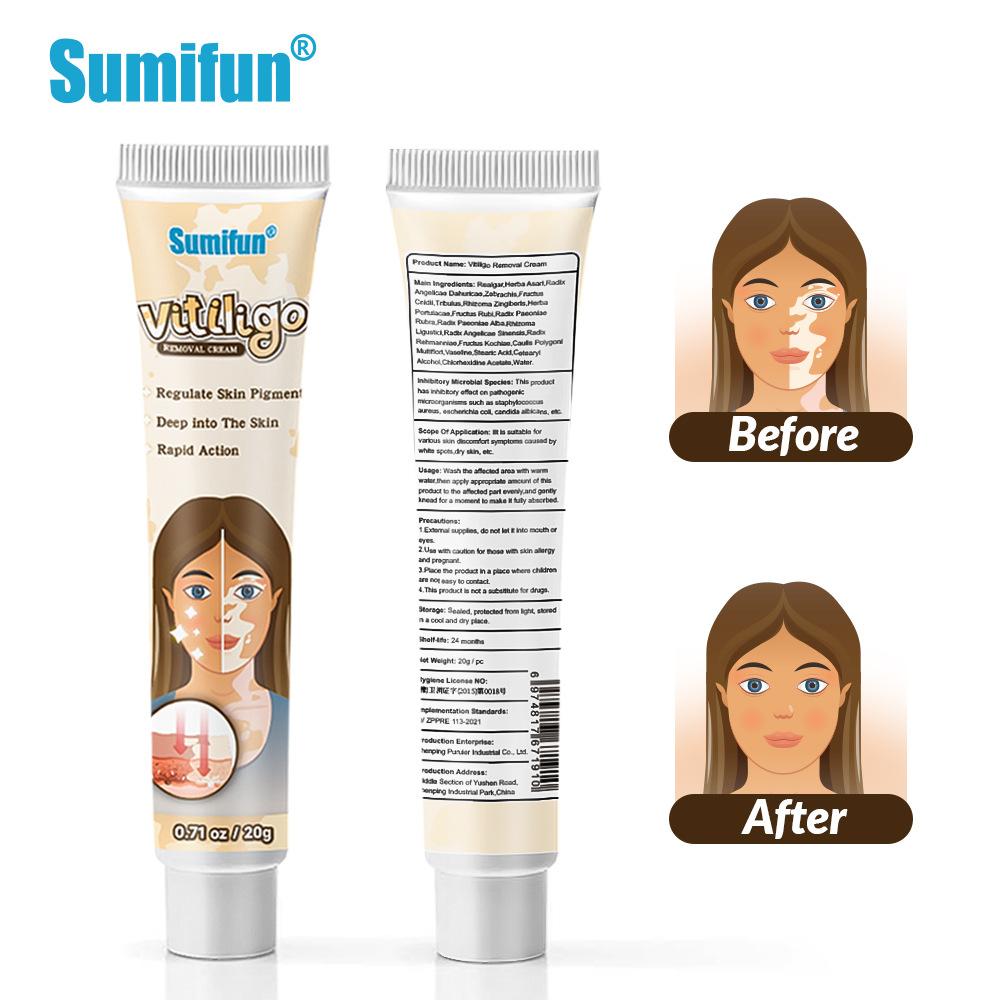 SUMIFUN Vitiligo Treatment Cream | White Spot Care & Antibacterial Herbal Cream for Skin Repair