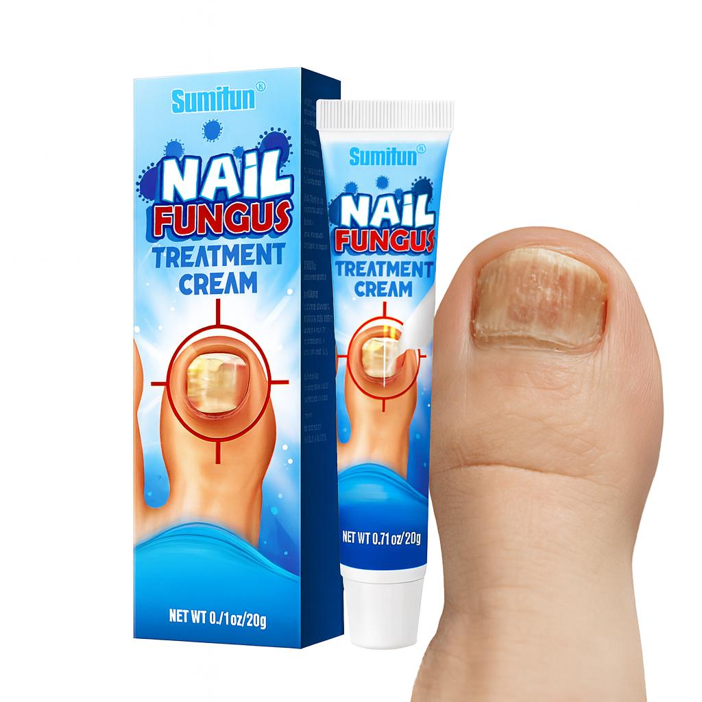 Sumifun Nail Fungus Cream 20g - Toenail Fungus Remover Treatment | Fast Acting Antifungal for Yellow Nails | Nail Care Solution
